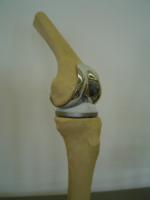 Model of Total Knee